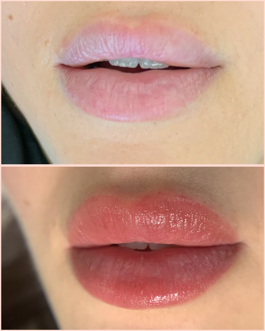 Lip Blush Neutralization